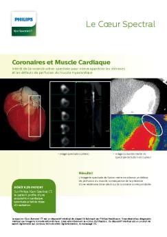 Le Cœur Spectral - Philips