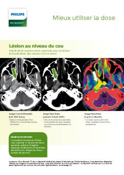 Mieux utiliser la dose - Philips